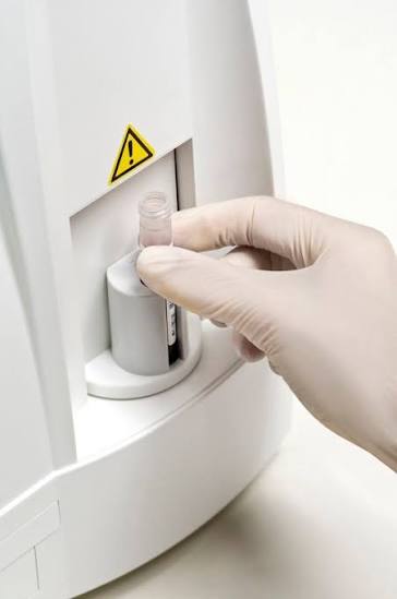 Abacus 380 Haematology Analyzer