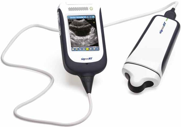 Signos RT Ultrasound Machine (Point-of-Care)